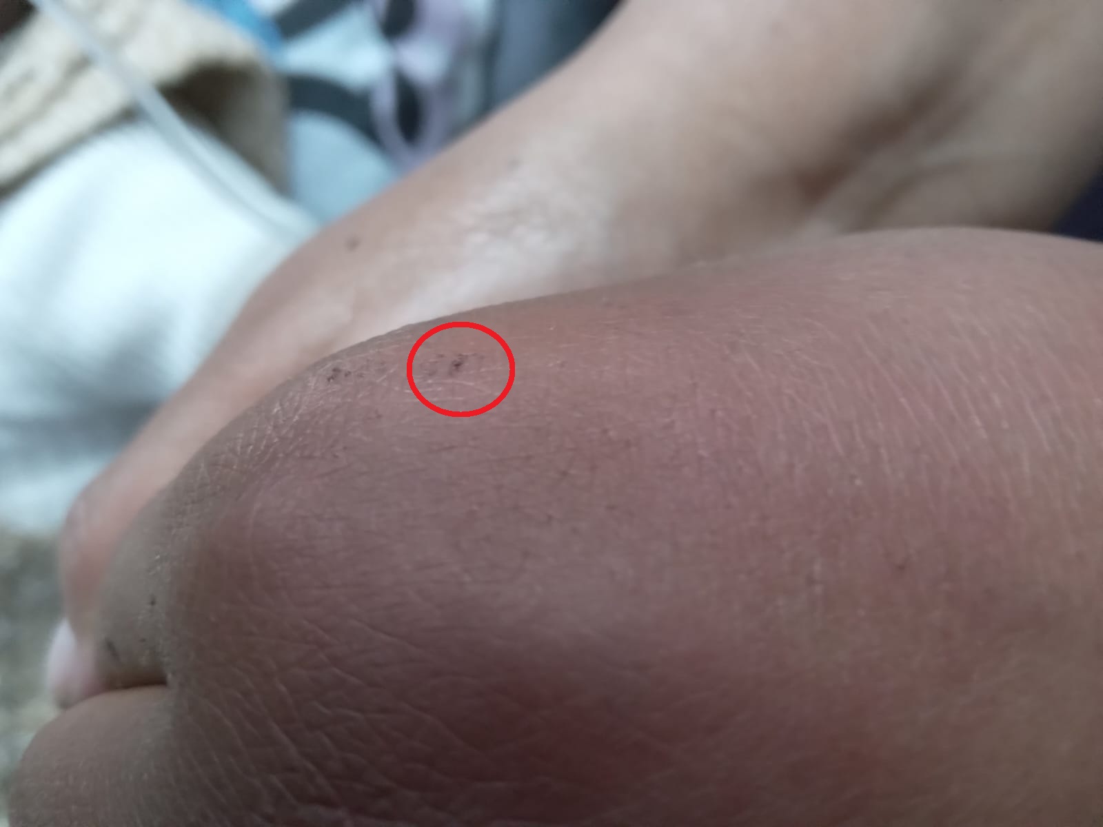 Cortesía: SEDES Oruro