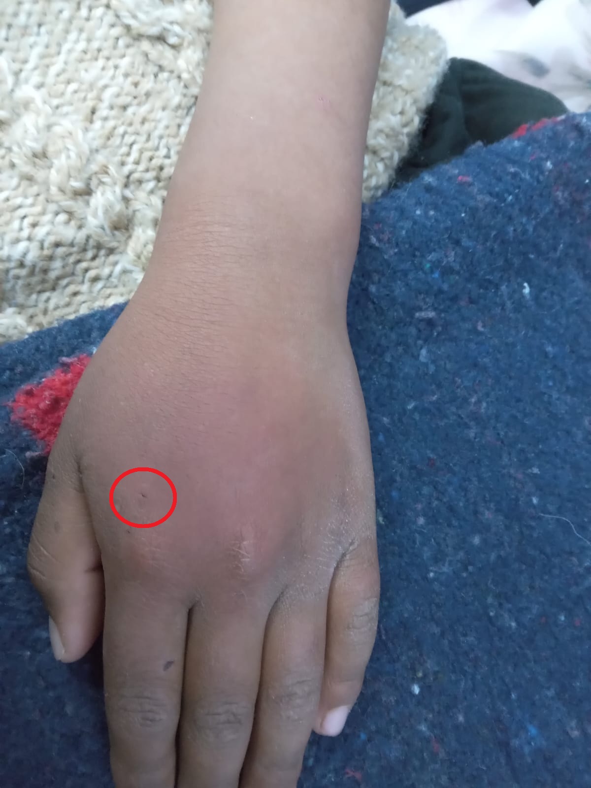 Cortesía: SEDES Oruro